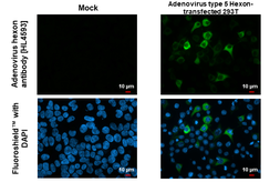 Anti-Adenovirus hexon antibody [HL4593] used in Immunocytochemistry/ Immunofluorescence (ICC/IF). GTX644269